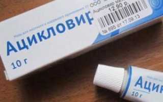 Ацикловир: таблетки, мазь