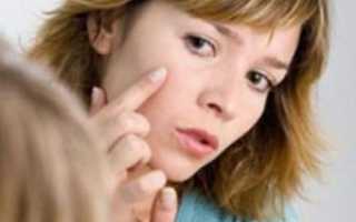 Угревая сыпь на лице – причины и лечение