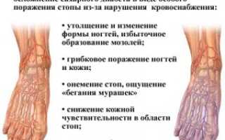 Диабетическая стопа – фото, лечение и симптомы в начальной стадии