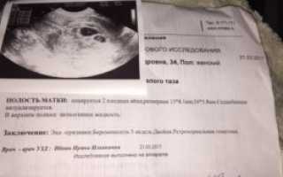 Могут ли на узи ошибиться со сроком беременности
